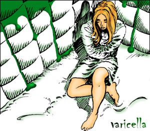 Varicella_0