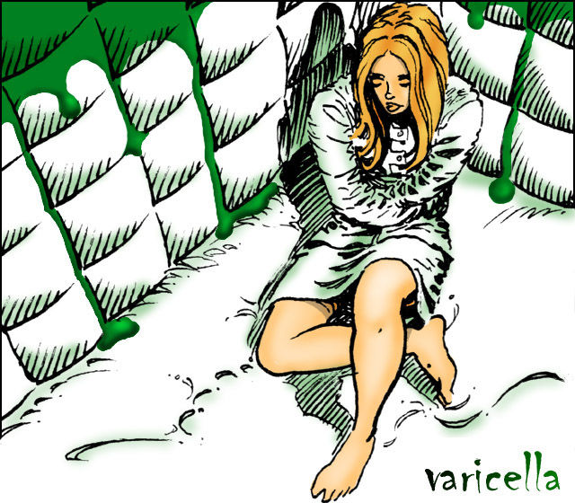 Varicella_0
